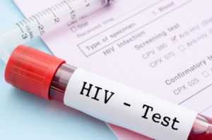 Как сдается кровь на обнаружение ВИЧ инфекции