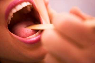 Можно ли проводить лечение стафилококка в горле