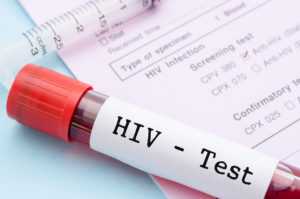 Виды тестов, необходимых при ВИЧ