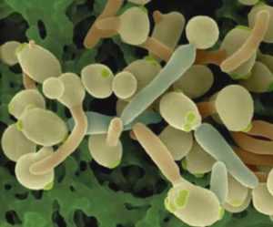 Возбудители – бактерии, грибы и даже вирусы