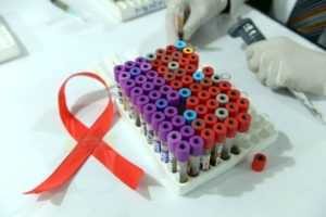 Альтернативные подходы для лечения ВИЧ и СПИДа