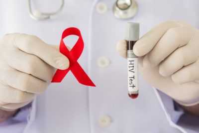 ВИЧ-инфекции - клиническая картина и стадии