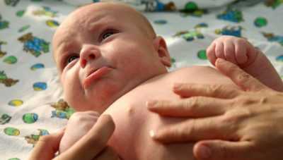 Непроходимость кишечника и её виды у новорожденных