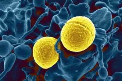Золотистый стафилококк (Staphylococcus aureus) в кишечнике человека