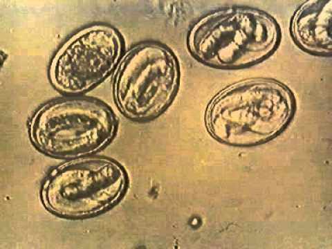 Яйца аскариды под микроскопом