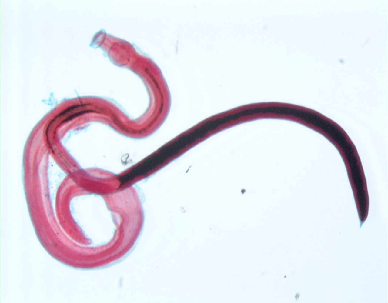 Schistosoma Intercalatum