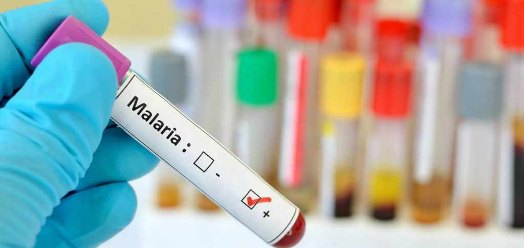 Основные методы лабораторной диагностики малярии у детей и взрослых