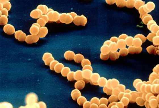 Лечение Staphylococcus Aureus