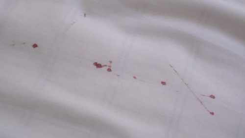 Следы крови на постели после укусов