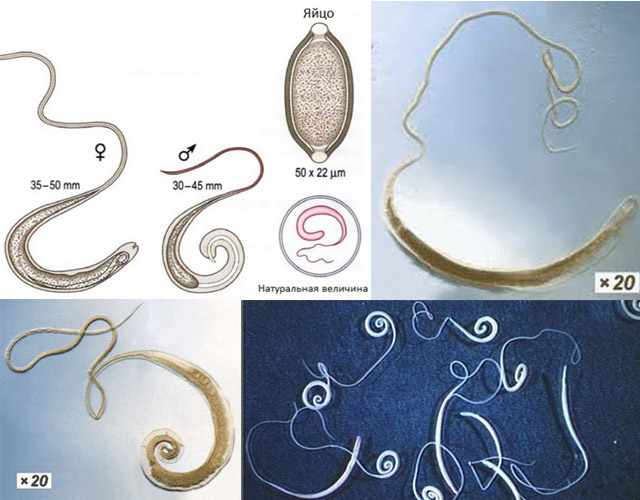 Внешний вид, строение и жизненный цикл паразита