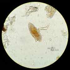 Личинка сосальщика под микроскопом