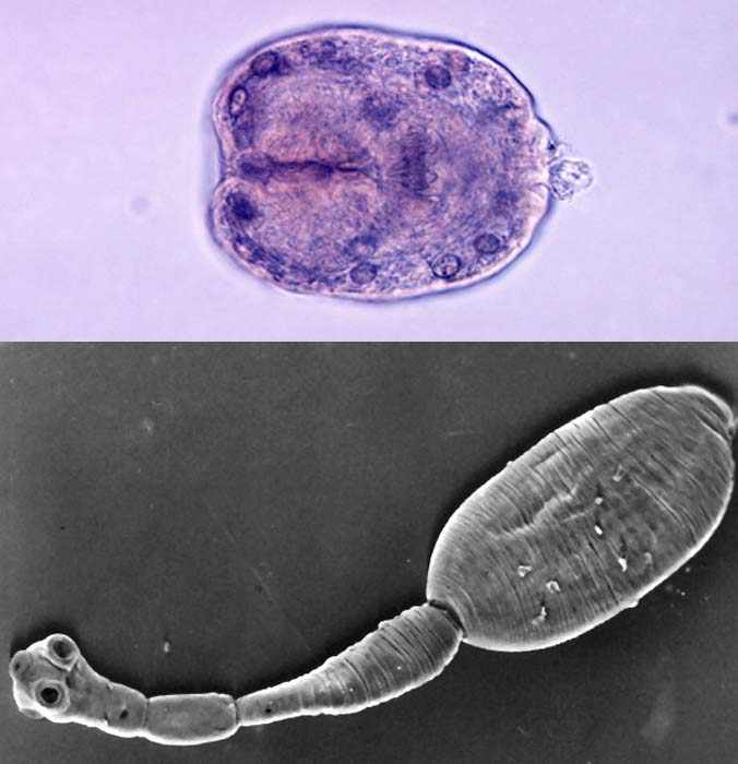 Ленточный червь Echinococcus granulosus
