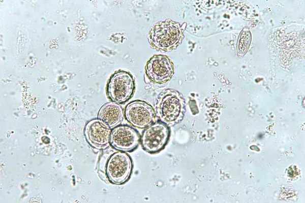 Яйца аскарид под микроскопом