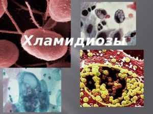 Сумамед при хламидиозе: насколько эффективен препарат в борьбе с хламидиями