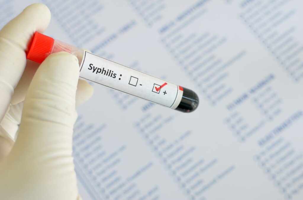 Кровь при сифилисе