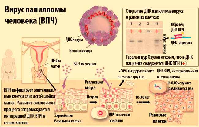 HPV — Human Papillomavirus
