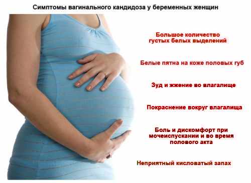 Симптомы молочницы при беременности 