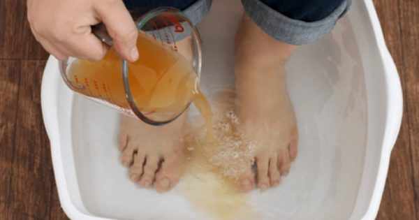Ванночка для ног с йодом
