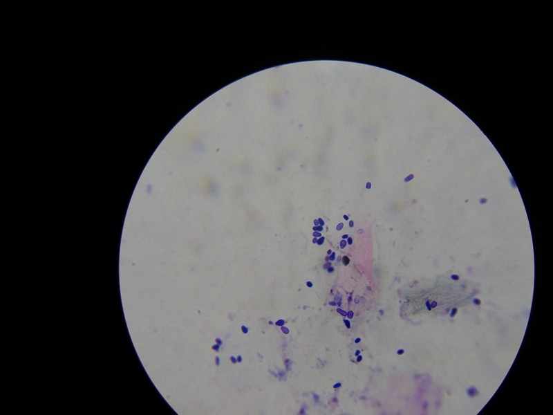 Грибы Malassezia под микроскопом
