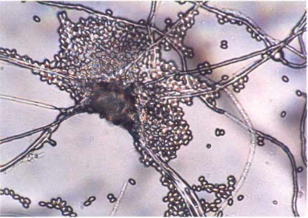 Микроскопия микоза кожи