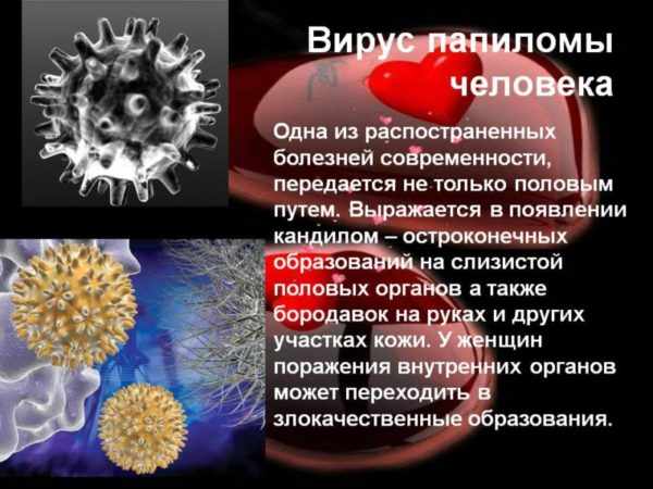 Вирус папилломы человека 