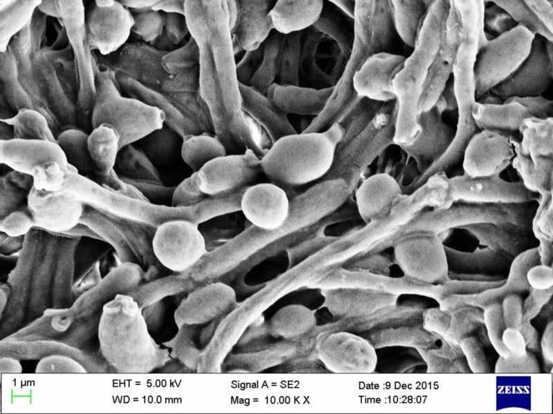 Грибок рода Candida под микроскопом