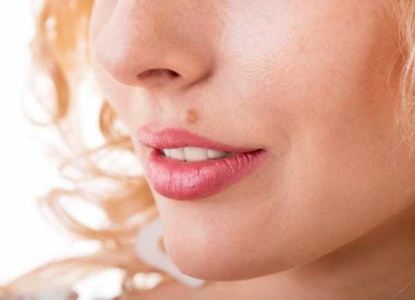 Как удалить папилломы на лице без шрамов